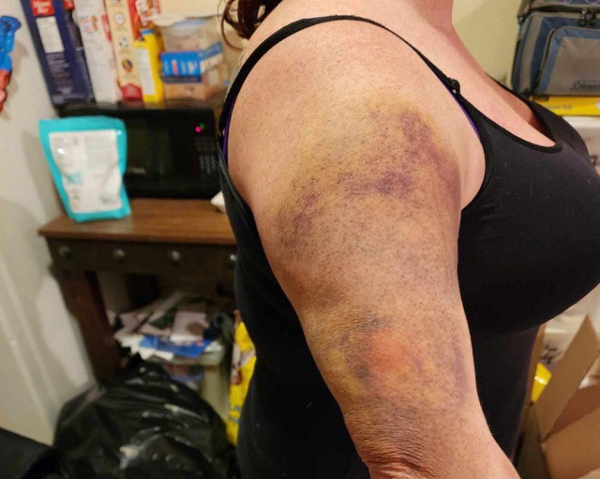 Judge refuses to accept guilty plea in assault case