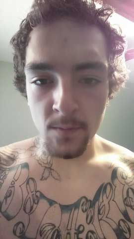 Colford says dog, then Ryan, attacked him