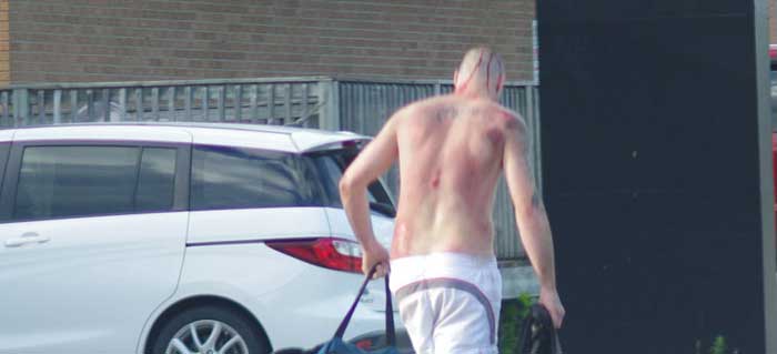 Bleeding man  fell out of car